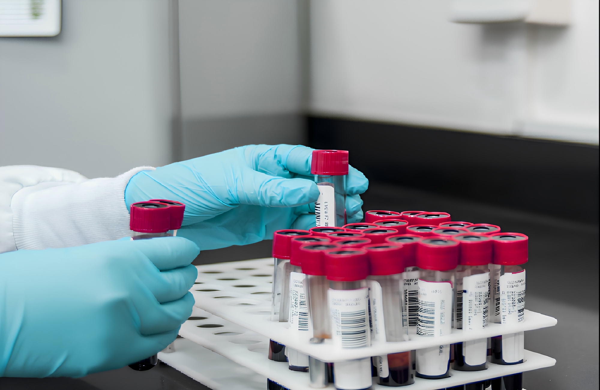 感染性疾病领域